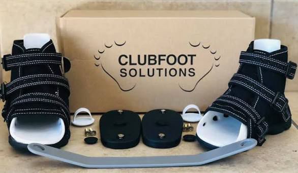 Clubfoot Deformity Correction